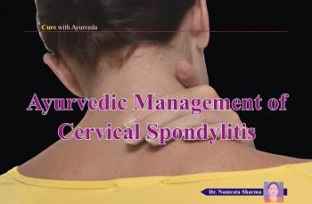 Ayurvedic Management of Cervical Spondylitis